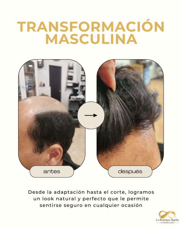 💇‍♂️🔥¿Te has planteado un cambio radical?

En La Boutique ʞapilar combinamos experiencia y técnicas avanzadas para lograr transformaciones masculinas espectaculares. Desde sistemas capilares hasta cambios de estilo, te ayudamos a lucir tu mejor versión. ¡Resultados que marcan la diferencia! 💥👨‍🦱

¡Descubre cómo podemos transformar tu imagen!

📲 Contacta con nosotros: + 34 631 655 001 - +34 604 880 203 - +34 865 55 44 37
📧 info@laboutiquekapilar.com
🌐 laboutiquekapilar.com

#TransformacionMasculina #CambioDeLook #SolucionesCapilares #RejuveneceTuImagen #EstiloMasculino #CuidadoCapilar #CabelloParaHombres #LaBoutiqueʞapilar #EsteticaCapilar